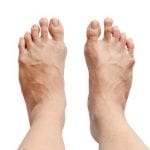 Foot Orthotics