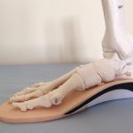 Custom-Made Foot Orthotics in Aurora, Ontario
