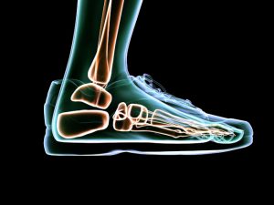 Who Can Benefit From Foot Orthotics?